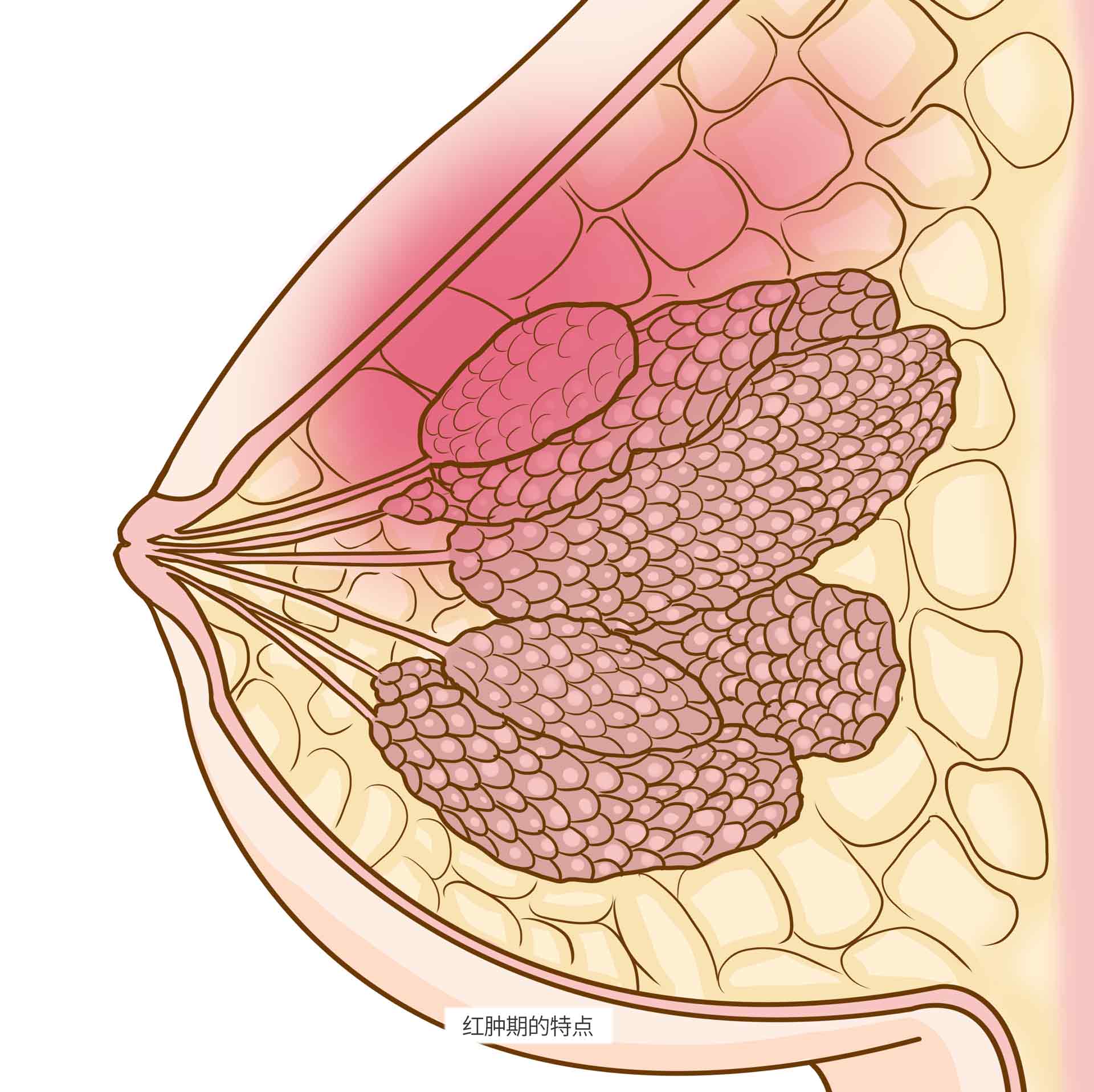 什么是乳腺炎 乳腺炎介绍 疾病百科 百科名医